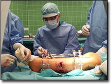 dr n. med. Jarosaw Kaakucki - ortopeda lublin, specjalista ortopeda lublin, ortopeda dziecicy lublin, traumatolog lublin, usg bioder lublin, dysplazja lublin